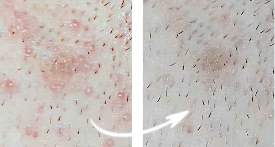 Woda po goleniu po co? Odkryj jej niespodziewane korzyści dla skóry Woda po goleniu po co? Odkryj jej niespodziewane korzyści dla skóry