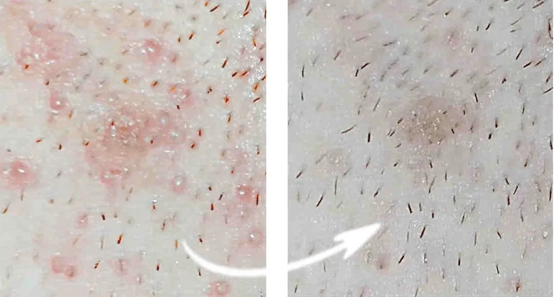 Woda po goleniu po co? Odkryj jej niespodziewane korzyści dla skóry