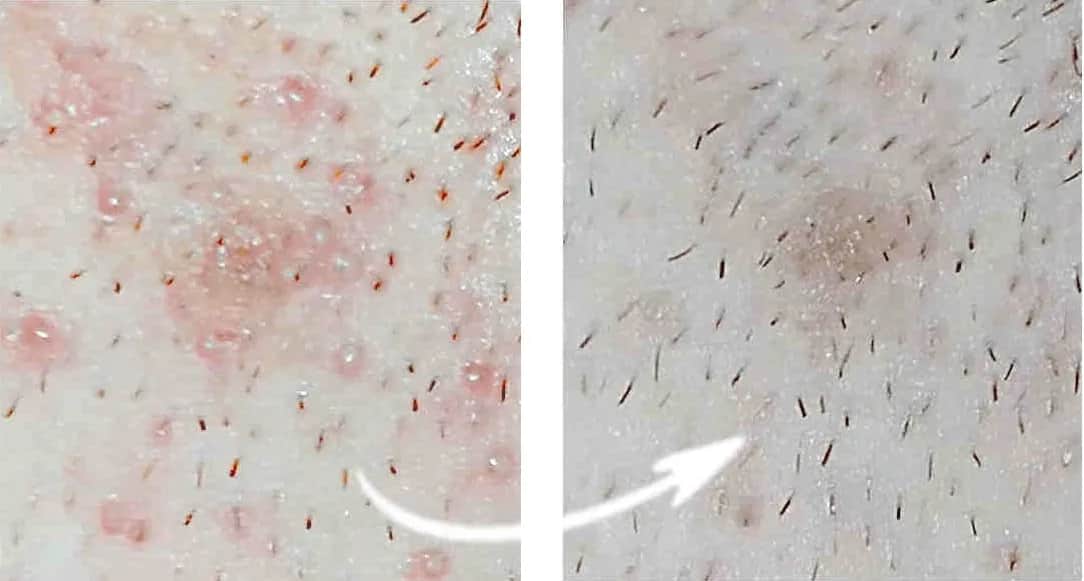 Woda po goleniu po co? Odkryj jej niespodziewane korzyści dla skóry