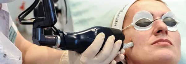 Kiedy znikają przebarwienia po laserze frakcyjnym? Oczekuj efektów