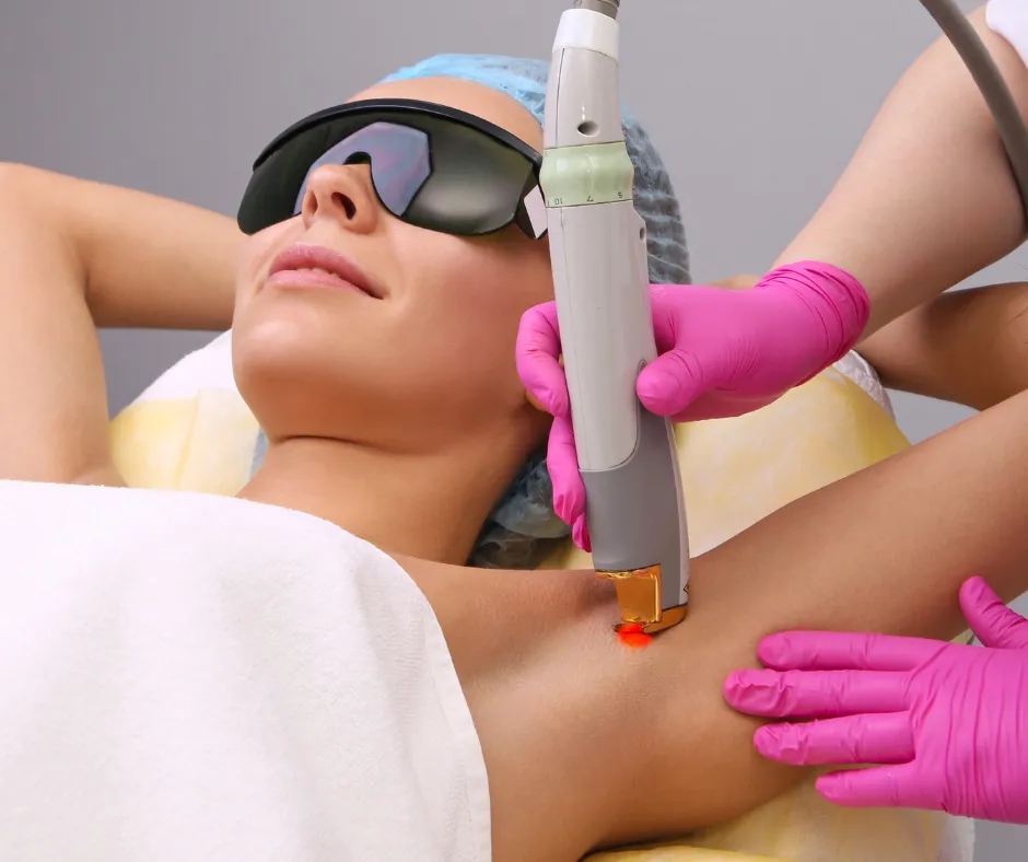 Czy po depilacji laserowej można się opalać? Ważne zasady ochrony skóry